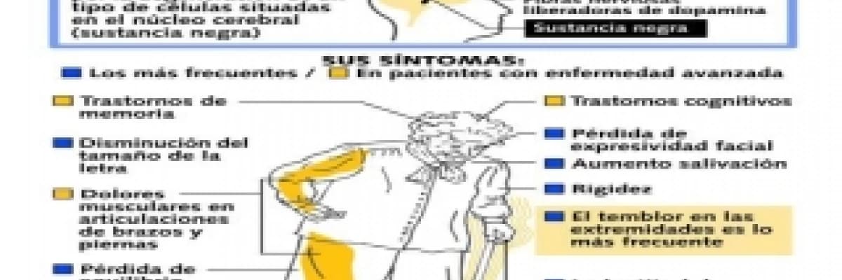 PARKİNSON HASTALIĞI TİTREME YURUME BOZUKLUĞU