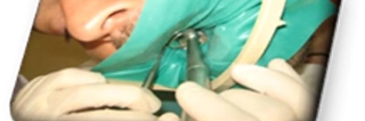 Rubber-dam Nedir ve Neye yarar?