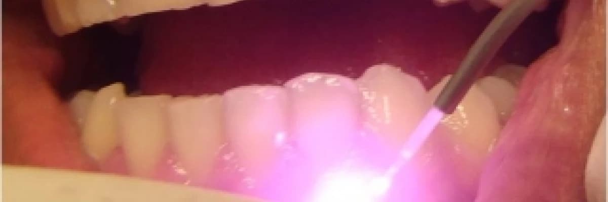 Lazer destekli diş hekimliği 'sorular ve cevaplar