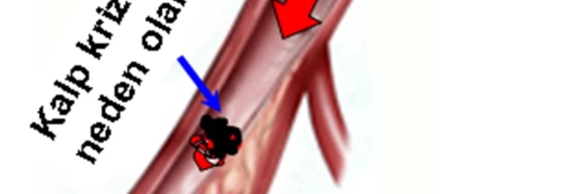 KOLESTEROL KONUSUNDA DOĞRULAR NEDİR ?