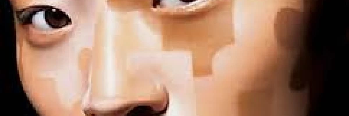 vitiligo, nedenleri ve tedavisi