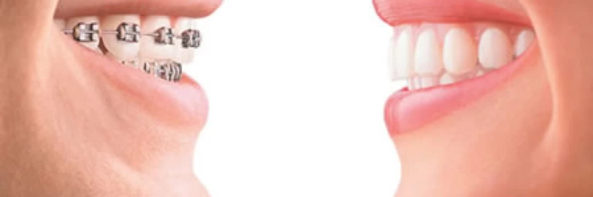 Ortodontide Merak Edilenler