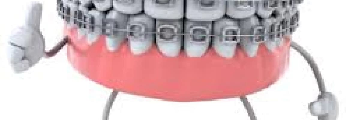 Ortodonti hakkında merak edilenler....