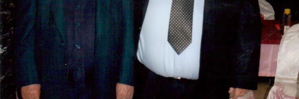 OBEZİTE NEDEN AMELİYAT EDİLMELİ?