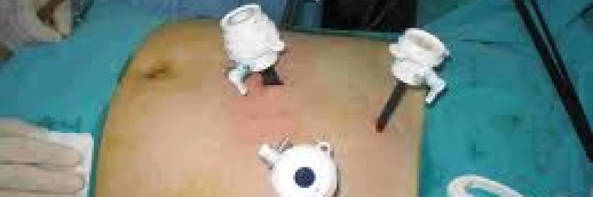 REFLÜ VE HİATAL HERNİ (MİDE FITIĞI)