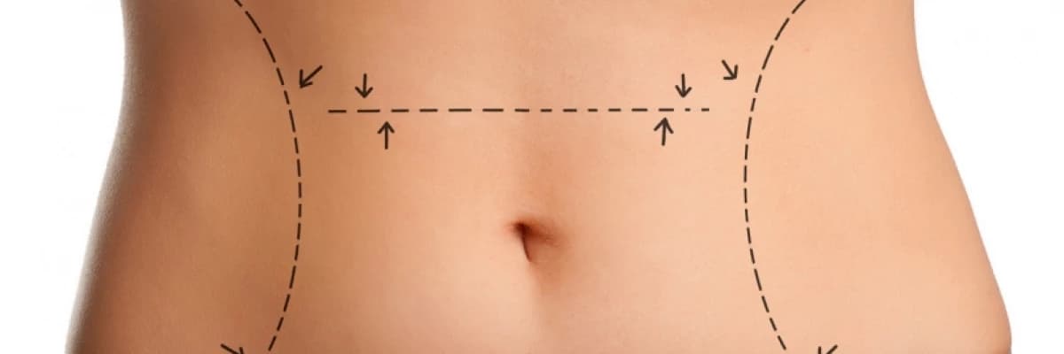 DOĞUM SONRASI ESTETİK UYGULAMALAR