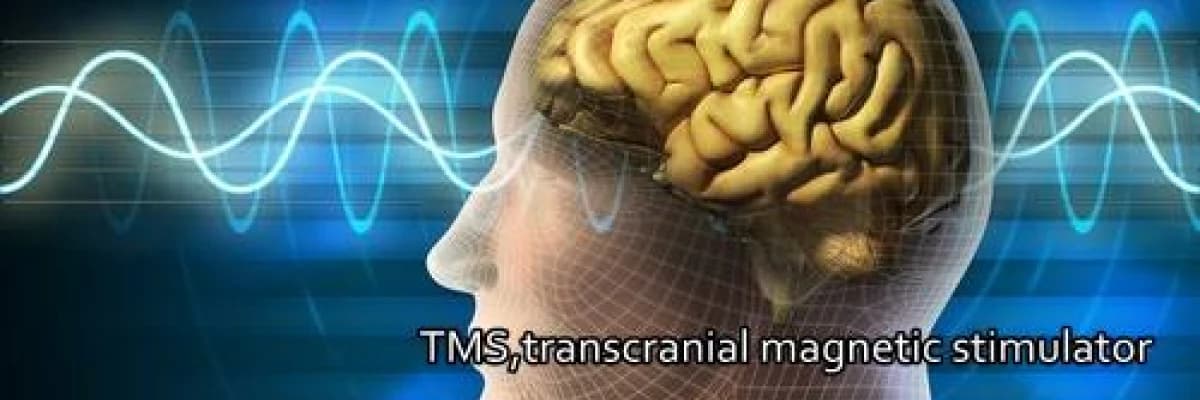 Kulak Çınlamasında yeni umut TMS tedavisi