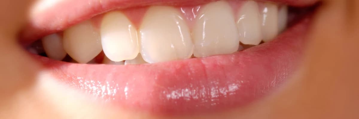 REFLÜ, DİŞ ÇÜRÜKLERİNDEN AĞIZ KOKUSUNA KADAR PEK ÇOK SORUNUN BAŞROL OYUNCUSU