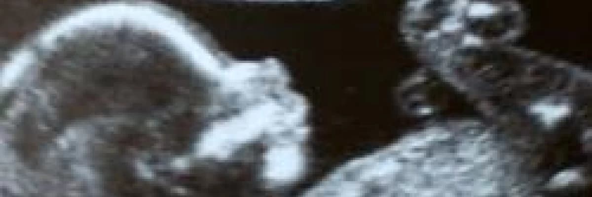 Gebelikte yapılan ultrason zararlımıdır????