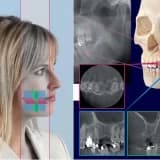 Volumetrik diş tomografisi