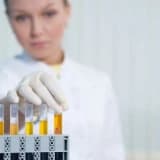 İdrarda protein fazlalığı (proteinüri)