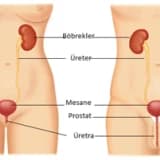 Erişkinlerin kanlı idrar (hematüri), kırmızı idrar yakınması ne anlama gelir?