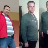 Diyabet Hastalığına cerrahi çözüm