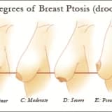 Memeler Neden Sarkar?