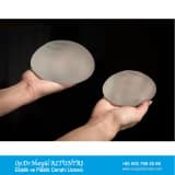 Meme büyütmede hangi yöntemler tercih ediliyor?