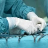 Fıtık Ameliyatı Riskli Midir?