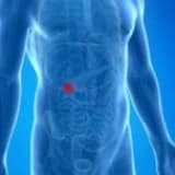 Kesi Fıtıklarında Ameliyat Sonrası