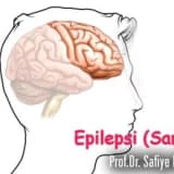 Epilepsi (sara) hastalığı nedir, tedavisi nasıldır?