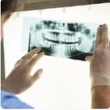 Röntgen (Radyografi)