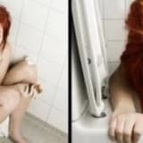 Bulimia Nervoza Nedir, Belirtileri Nelerdir ?