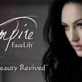 Vampire Facelift