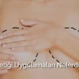 Meme Estetiği Uygulamaları Nelerdir?