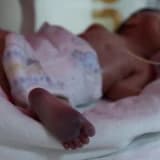 Çocuklarda Doğumsal Kalp Hastalıklarının Belirtileri