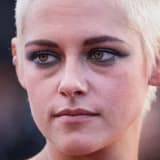 Göz altı ışık dolgusu ve göz yaşı oluğu dolgusu nedir, nasıl yapılır?