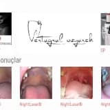 NightLase Lazer Horlama ve Uyku Apnesi Tedavisi