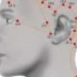 Akupunkturun tarihçesi, türkiyede ve dünyada akupunktur