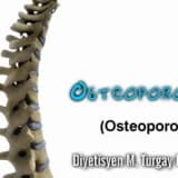 Osteoporoz!