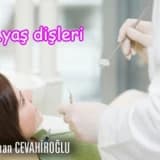 20 yaş dişi mutlaka çekilmeli midir?