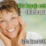Göz kapağı estetiği (blefaroplasti)