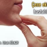 Çene eklemi hastalıklarının sebepleri