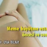 Meme büyütme estetiği öncesi ve sonrası