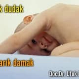 Yarık dudak ve yarık damak