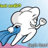 İmplant nedir? kimlere implant uygulanabilir?