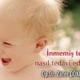 İnmemiş testis nasıl tedavi edilir ?