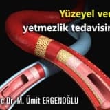 Kılcal damarların tedavisi: skleroterapi