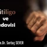 Vitiligo ve tedavisi