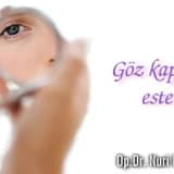 Göz kapağı estetiği!