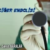 Akciğer embolisi
