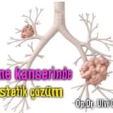 Meme kanserinde estetik çözüm