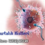Yumurtalık (over) kisti ve cerrahi operasyon