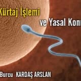 Kürtaj işlemi ve yasal konular