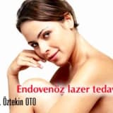 Varislerin endovenöz lazer yöntemi ile tedavisi