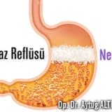 Boğaz reflüsü nedir ?