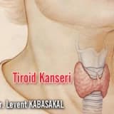 Tiroid kanseri