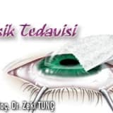 Lasik tedavisi