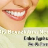 Diş Beyazlatma Nedir ? Kimlere Uygulanabilir ?
